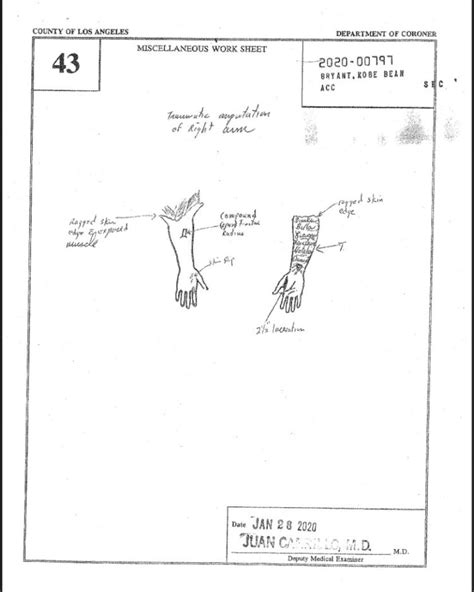 gigi bryant autopsy|Gigi Bryant Autopsy: Photos, Report, and Cause of Death